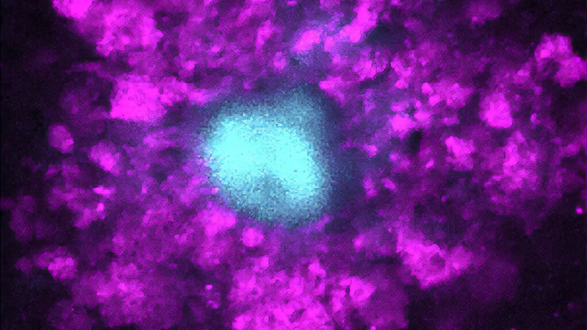 Yale Research May Uncover The True Cause Of Alzheimer s Swelling Of 