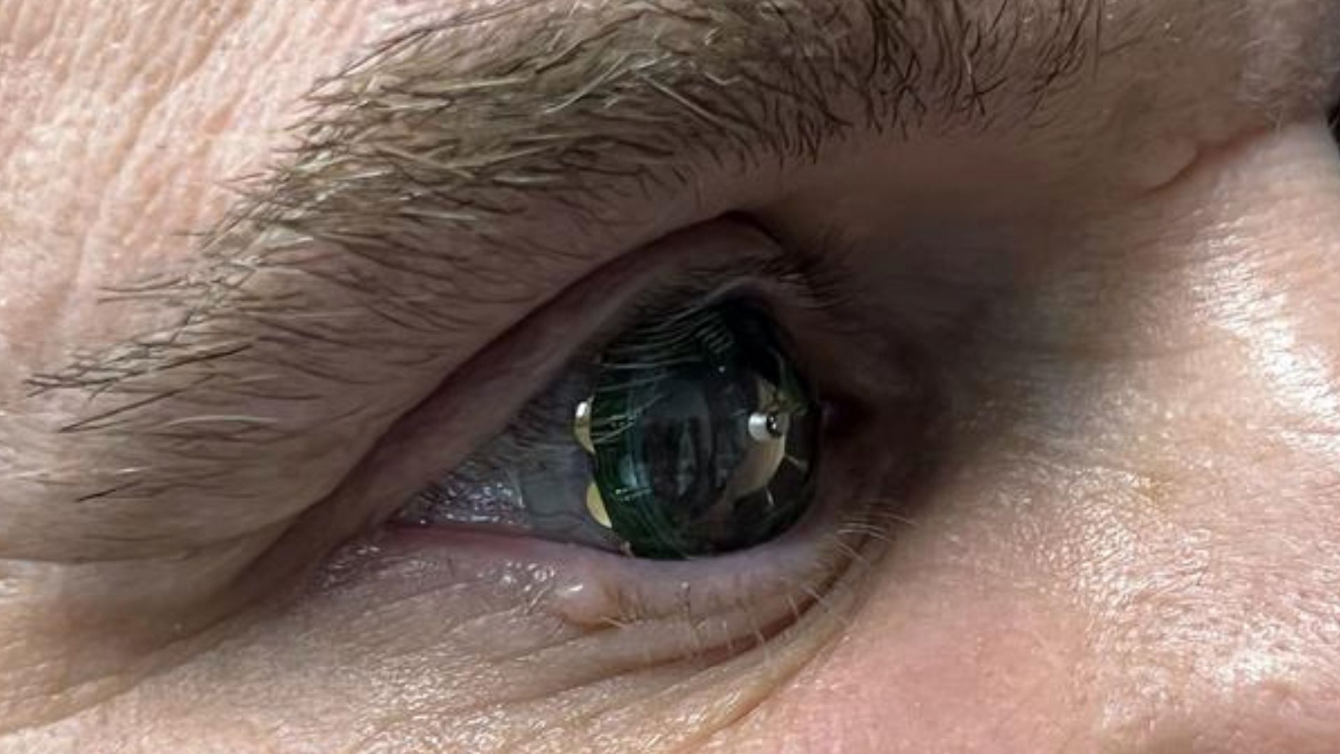 Mojo smart contact lenses with AR display trialed for the first time