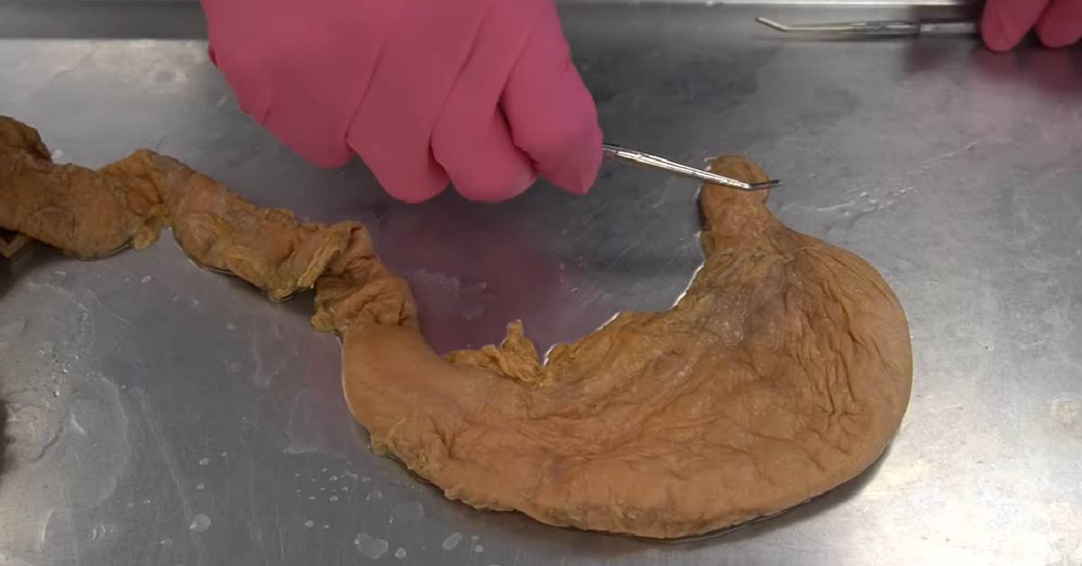 Man Explores How Much Food the Human Stomach Can Hold IE